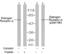 ER alpha/NR3A1, p Ser106 Antibody, Novus Biologicals 0.025 mL; Unconjugated:Antibodies,